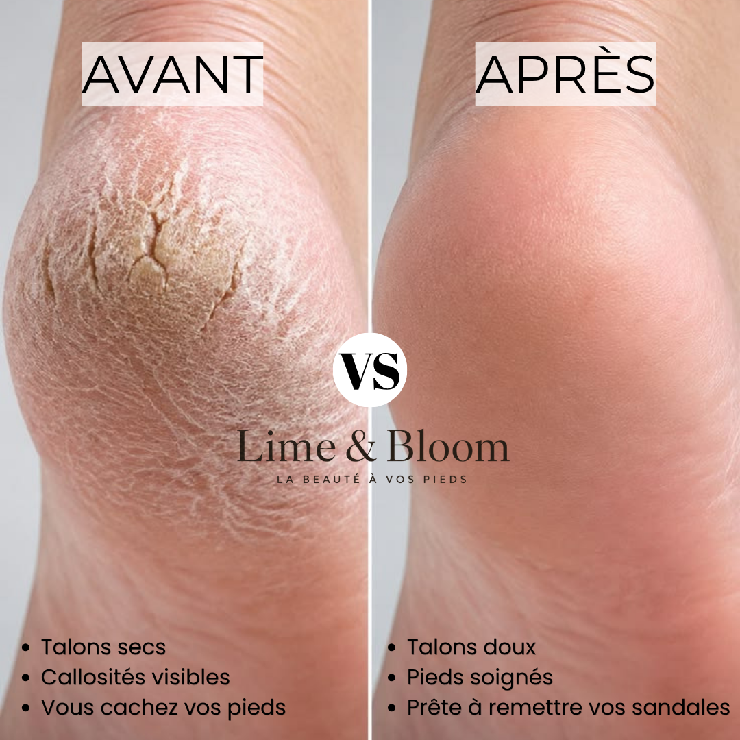 Lime électrique anti-callosités — Lime&Bloom™
